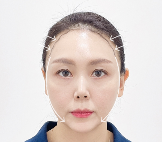 Round face shape